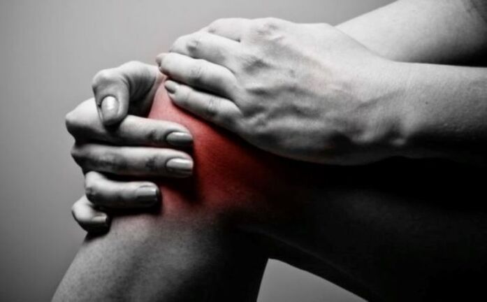 Artritis de la articulación de la rodilla