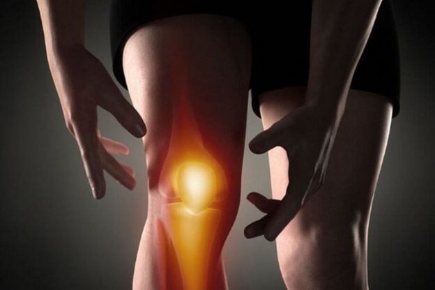 Inflamación en la articulación de la rodilla