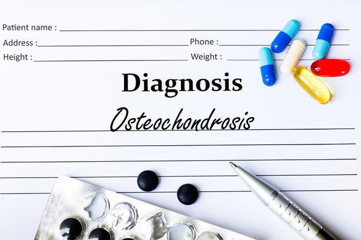 medicamentos para diagnosticar la osteocondrosis