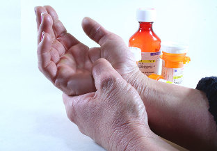 métodos para tratar la artritis y la artrosis