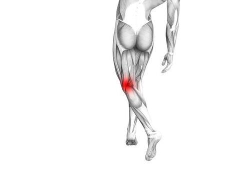 Osteoartritis de la articulación de la rodilla.