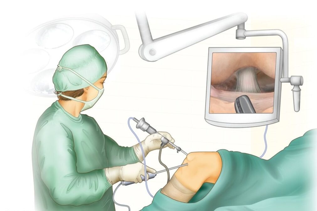 cirugia de rodilla