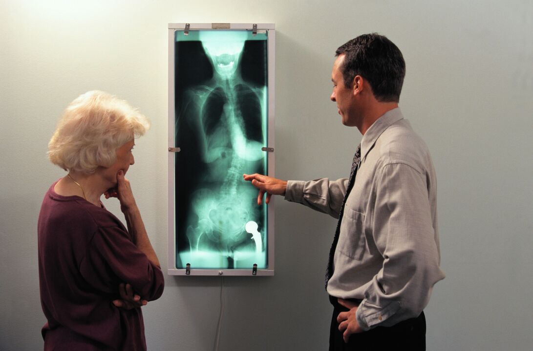 diagnóstico de rayos x para el dolor en la articulación de la cadera